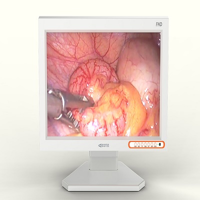 醫(yī)用灰階顯示器用過的評價如何