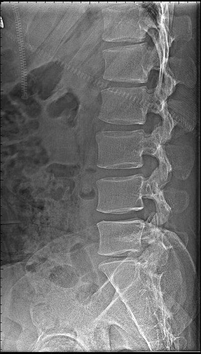 怎么才能選購好醫(yī)用高清攝像機